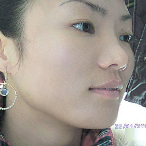 ps怎么去除痘印？ps利用通道快速去除脸上可怕的痘痘教程